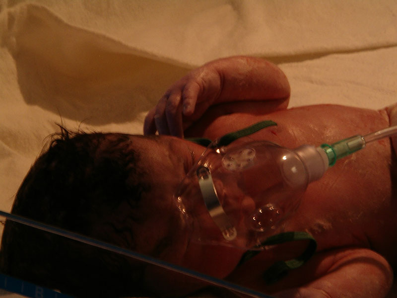 Right After Birth 1