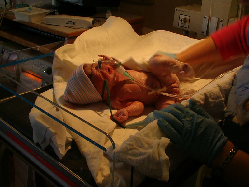 Right After Birth 2