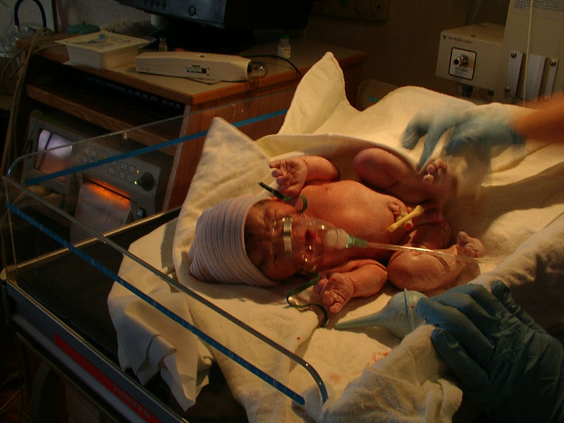 Right After Birth 3